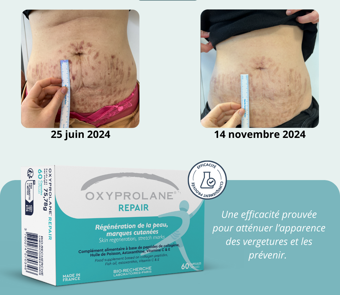 OXYPROLANE ANTI VERGETURE